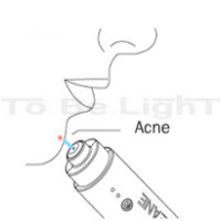 CLEANE®  : traitement de l acné